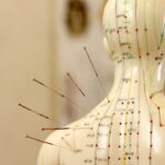 De invloed van acupunctuur op sporters
