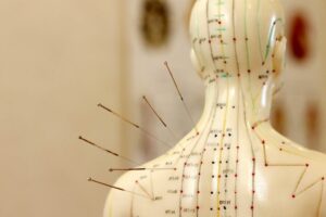 Lees meer over het artikel De invloed van acupunctuur op sporters