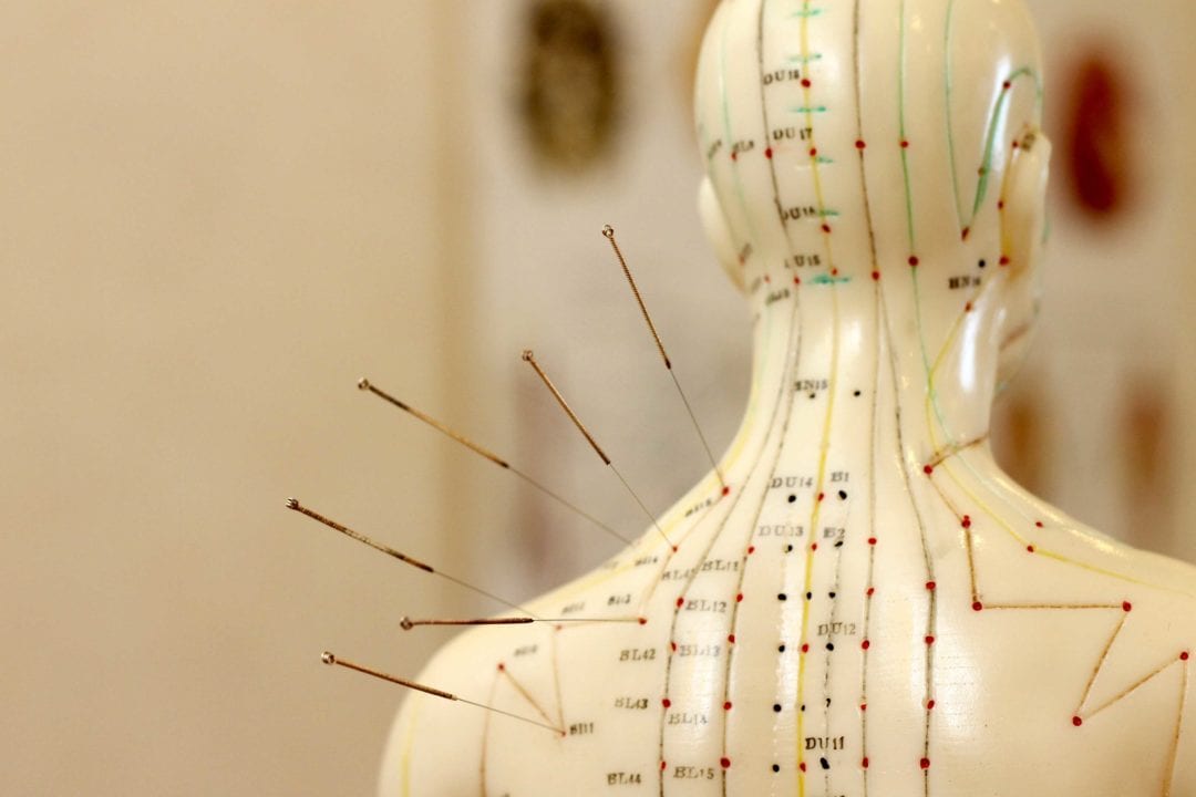 Je bekijkt nu De invloed van acupunctuur op sporters